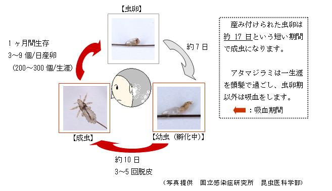 アタマジラミってどんな虫？